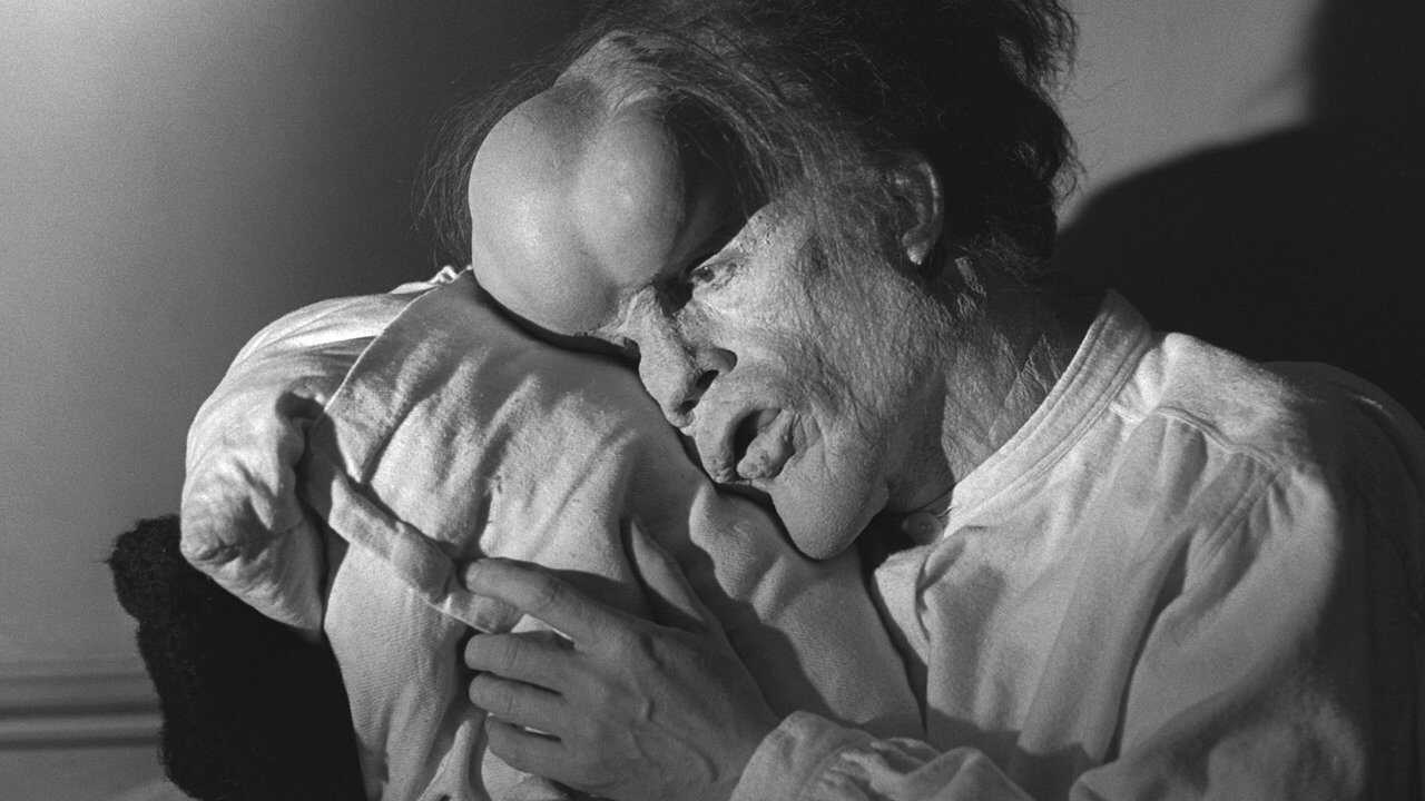The Elephant Man 0