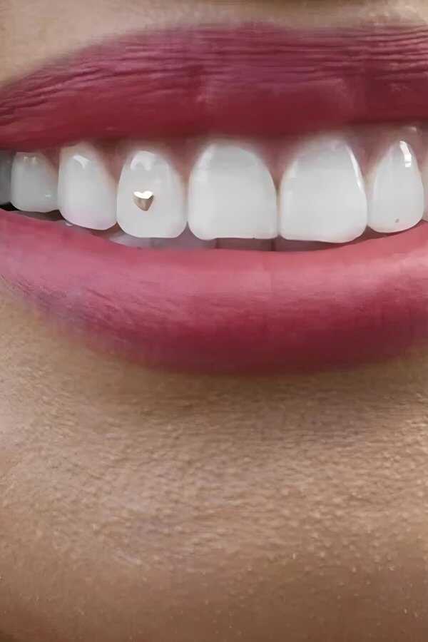 Open Wide (2024) 0